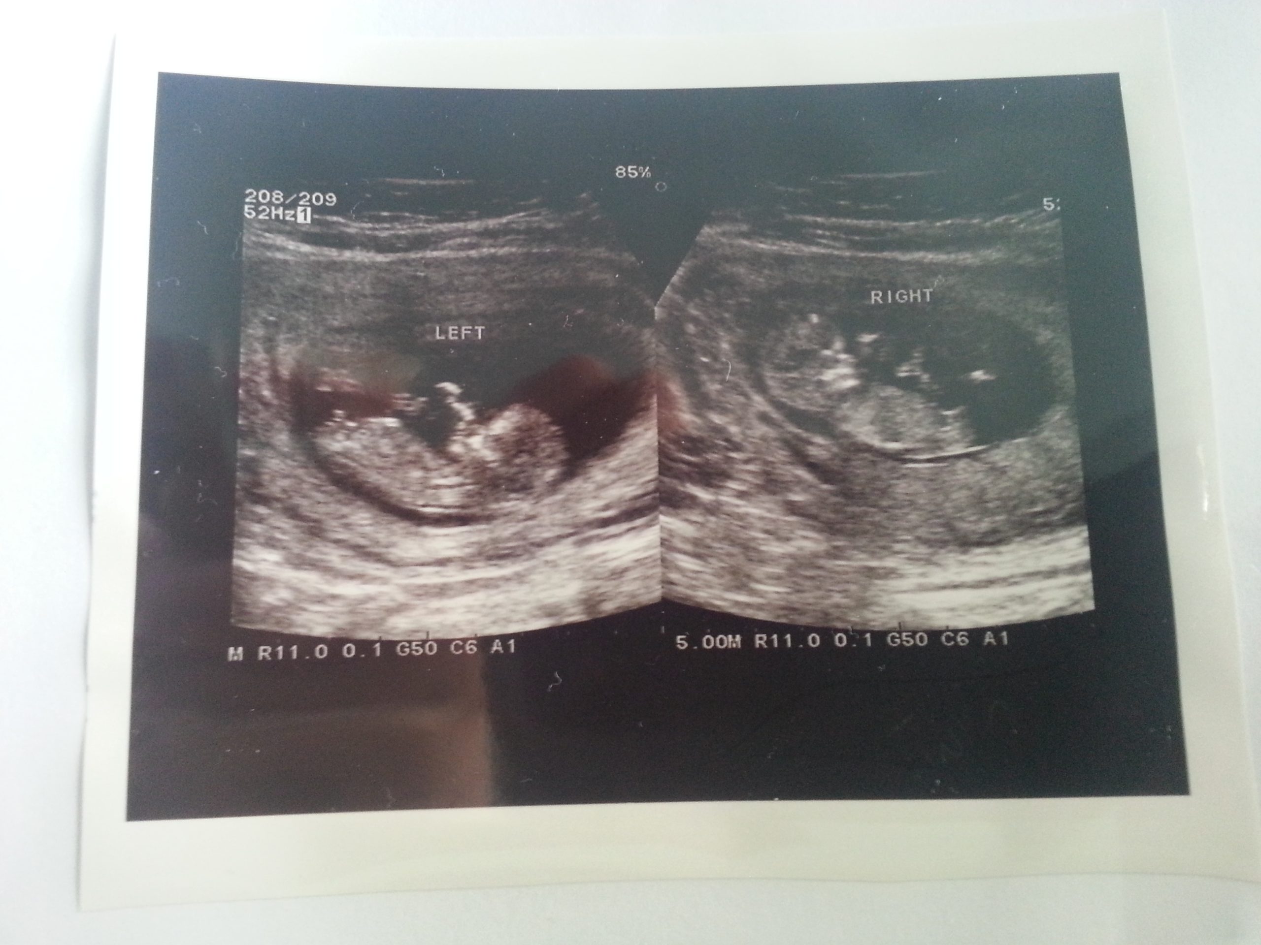 刘家证 – Elvis Low Kay Cheng, 刘家诚 – Louis Low Kay Seng